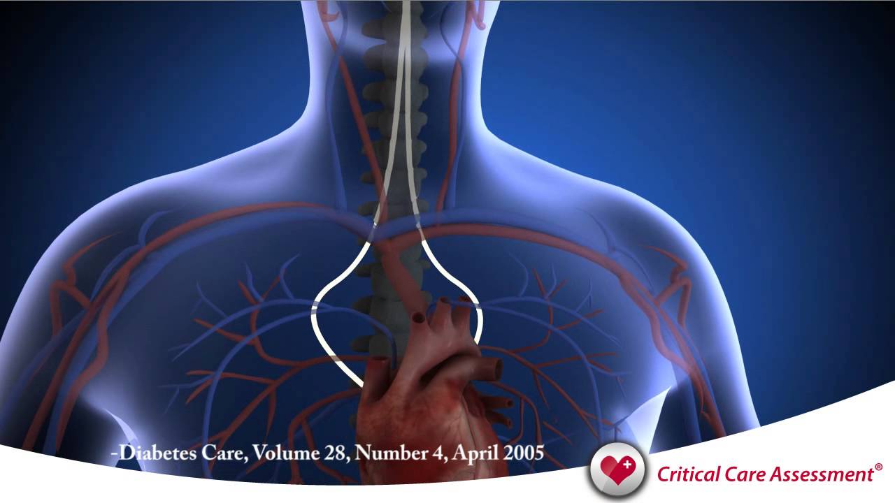 Critical Care Assessment Guyer Wellness Group Critical Care Assessment Guyer Wellness Group