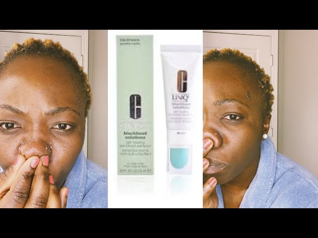 Clinique blackhead solutions review - YouTube