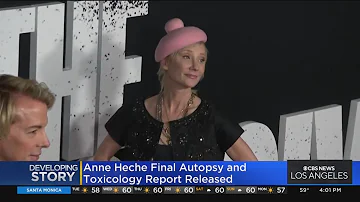 Anne Heche's final autopsy and toxicology report released