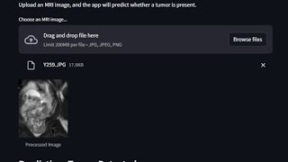 Brain Tumor Detection using CNN(Part#1)