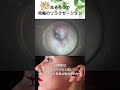 耳掃除は奥までやるものだと信じて・・押し込まれた耳垢は取れるのか？ #イヤーエステ #イヤーエステ #耳掃除 #耳かき動画 #耳掃除 #耳かき動画 #eariss