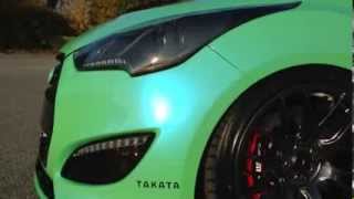 Fox Marketing Hyundai Veloster Turbo 370hp@23psi