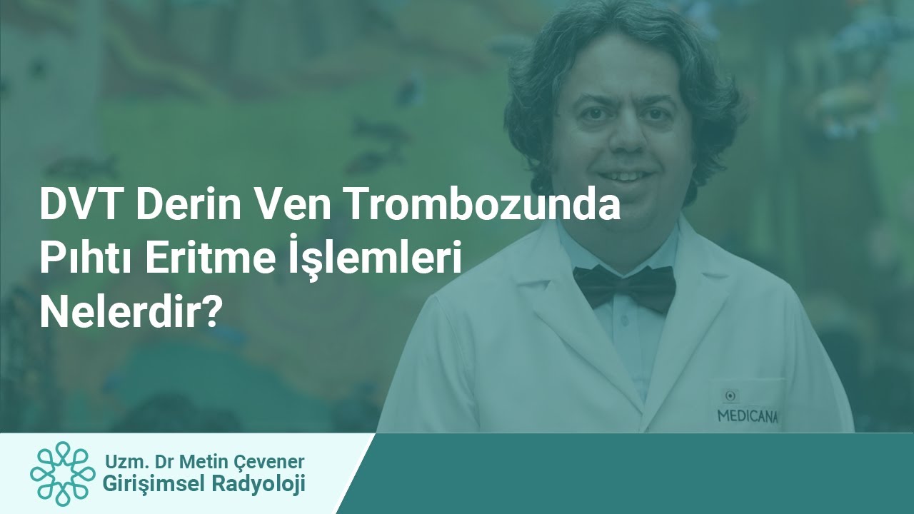 DVT Derin Ven Trombozunda Pıhtı Eritme İşlemleri Nedir?