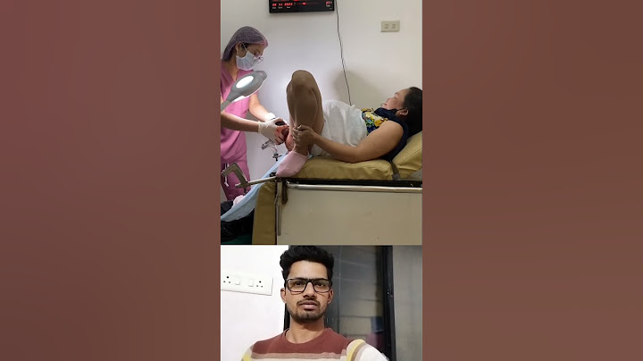 Mother painfull delivery newborn  twins baby 😘💕! #shorts #ytshorts #mbbs #hospital #newbornbaby #new