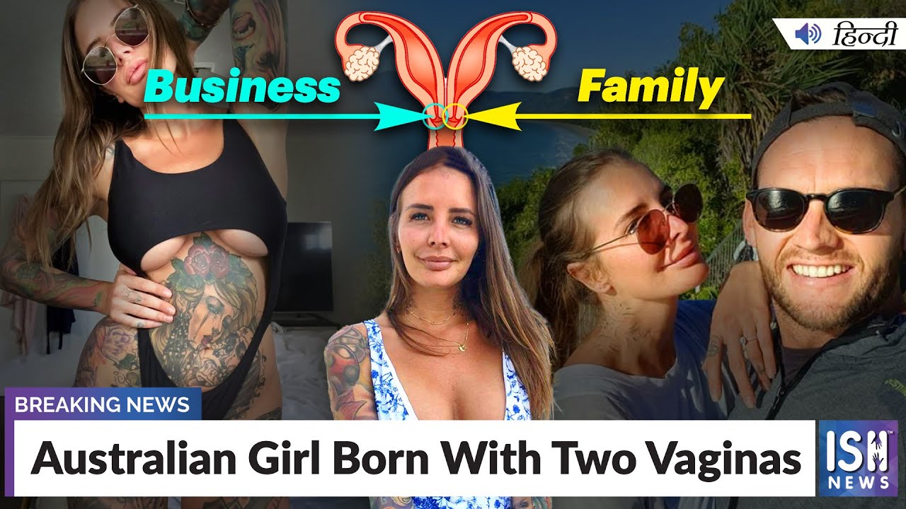 Australian Girl Born With Two Vaginas ISH News pic image