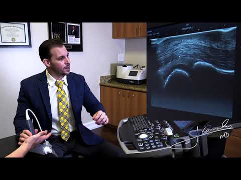 How Trigger Finger Is Diagnosed With Ultrasound | Fort Lauderdale