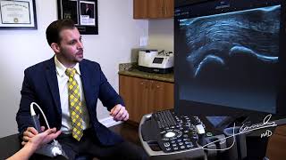 How to diagnose Trigger Finger in the office using high resolution ultrasound