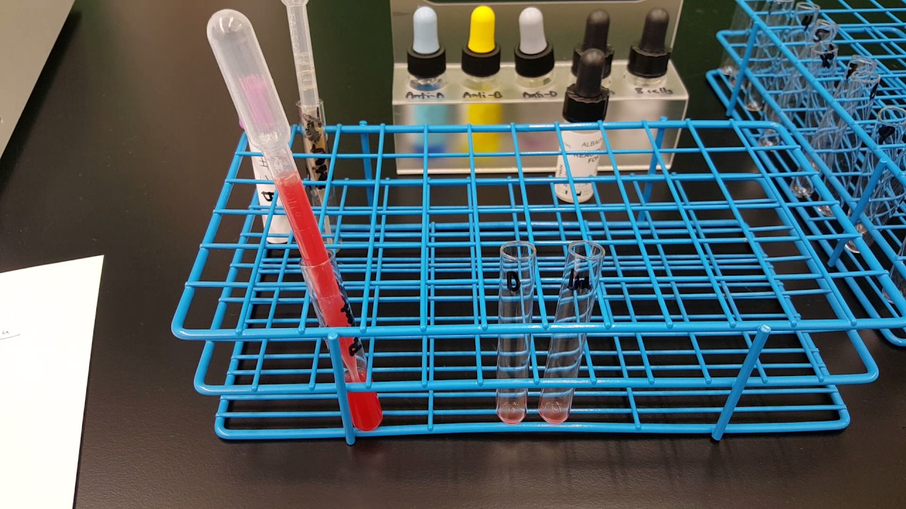 Blood Banking: Weak D test Part 2 - YouTube