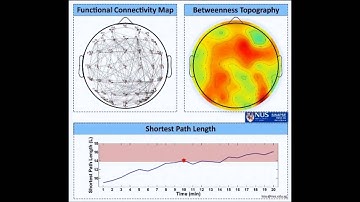 Mental Fatigue Monitoring Using Connectivity-based EEG Analysis