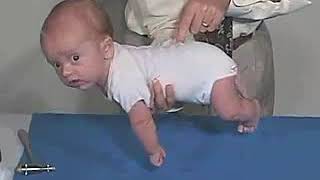 5.15 - Primitive Reflexes, Galant Reflex - 3 Months - Infant Clinical Examination (MRCP)