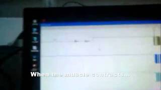 A Demonstration of Wireless EMG Signal Acquisition