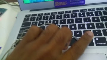 Arduino Based Ecg Monitoring Healthcare System Using Gsm-1crore Projects