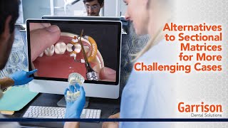 Alternatives to Sectional Matrices for More Challenging Cases