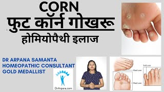 फुट कॉर्न गोखरू की होम्योपैथिक दवा | FOOT CORN Ka HOMEOPATHIC TREATMENT screenshot 4