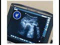 The SOAPBOX- Multifidus on LIVE ULTRASOUND!!!