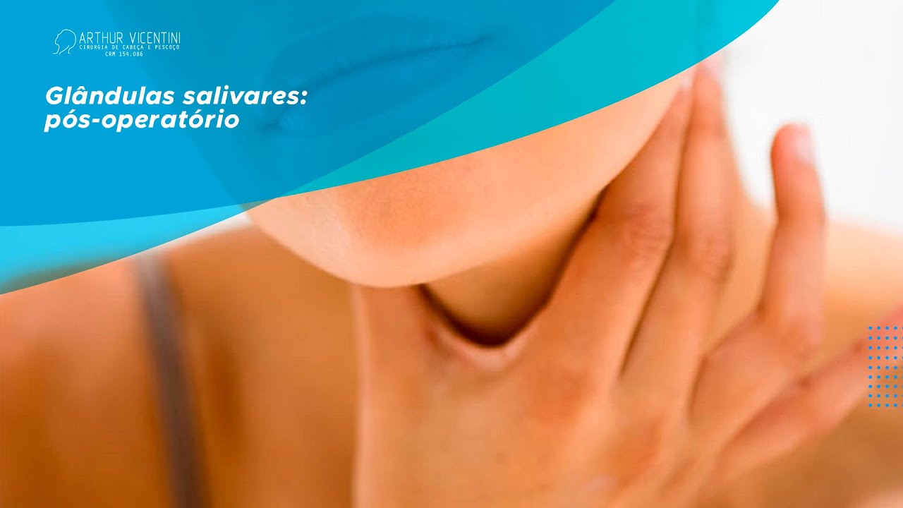 Glândulas salivares: pós-operatório | Dr. Arthur Vicentini CRM 154.086