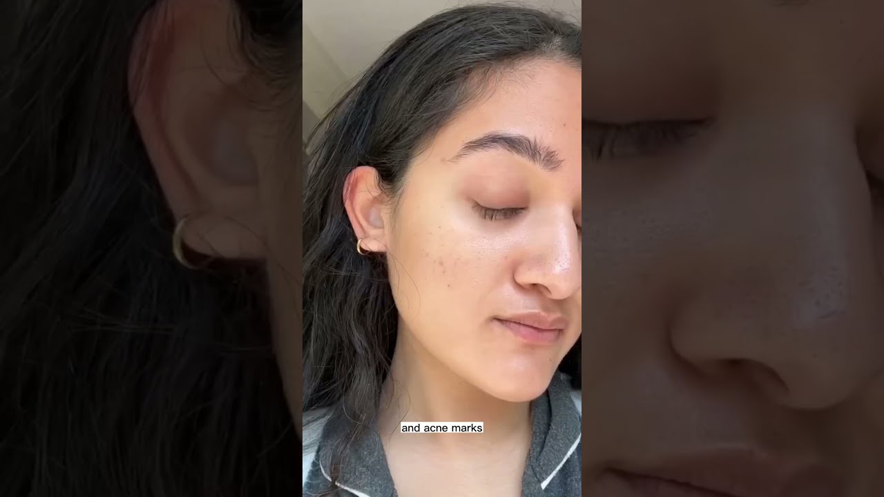 This Is What REAL Skin Looks Like