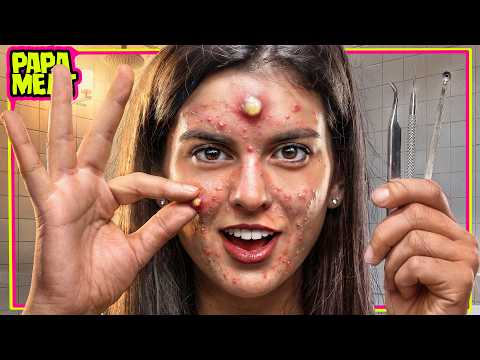 Pimple Poppers Won't Stop...
