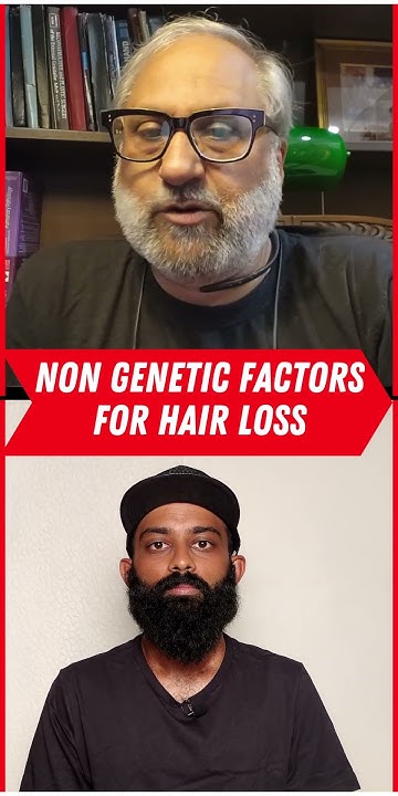 HAIR LOSS WITHOUT GENETIC REASON hairloss hairfall YouTube hair-loss-without-genetic-reason-hairloss-hairfall-youtube