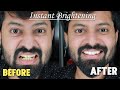 Best Teeth Whitening Trick Ever 😍 | Natural Remedy |  Tamil | பற்கள் வெண்மையாக்குதல் | Shadhikazeez