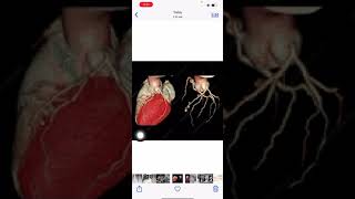 مع الاستشاري د.نبيل عبد اللطيف  Update of Cardiac X Ray informative video for doctors and students