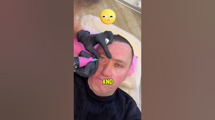 The woman made a tattoo on the man's eye! 👩‍🎨👁️