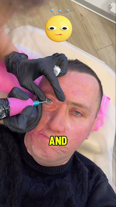 The woman made a tattoo on the man's eye! ๐ฉโ๐จ๐๏ธ