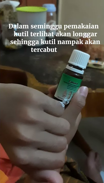 Obat menghilangkan kutil