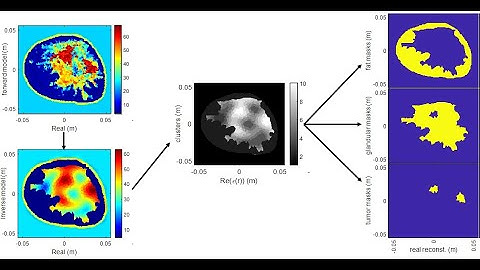Heterogeneously Dense microwave breast image segmentation