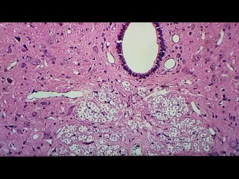 Vídeo: O que especificamente é encontrado no corno cinza anterior da medula espinhal?