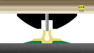 Cito - C3