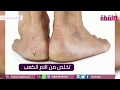 كعب القدم من جلد السليكون لتخفيف الألم الخاص بالكعب 