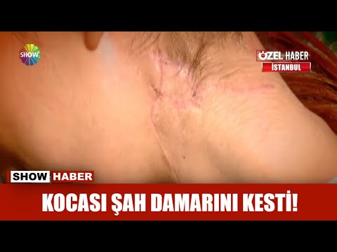 Kocası şah damarını kesti!