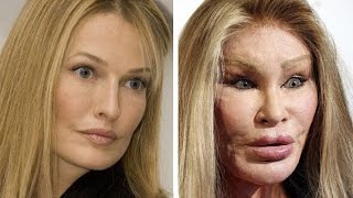 15 CELEBRITY PLASTIC SURGERY THAT WENT HORRIBLY WRONG