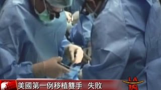 [美國一男子想移除移植手臂] 洛城18台晚間新聞07262016