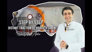 Step by step distant traction of dracula canine by power chain
