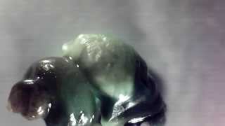 Cercariae Imaging From A Gastropod Host