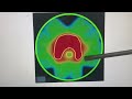part 2 :- Kaise chune Radiotherapy ki sahi takneek  I Hindi I #radiation #hindi #cancer #india
