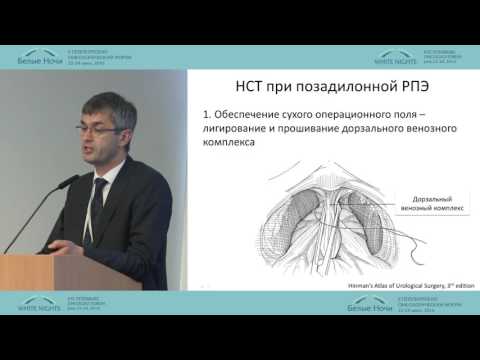 Нервосберегающая радикальная простатэктомия