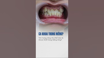 Niềng Răng: Hàm Răng Thế Nào Sẽ Khó Chỉnh Nha | Niềng Răng Chỉnh Nha | Niềng Răng Mắc Cài