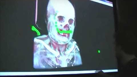 Touchless Interaction for Surgery