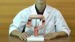 腸疾患モデル：動画