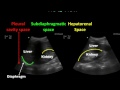 Basic ultrasound course efast