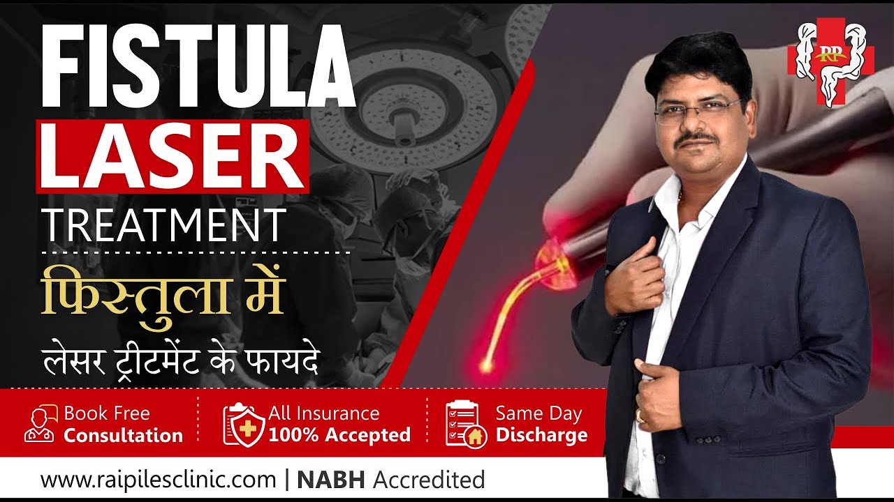 Laser Treatment In Fistula | फिस्तुला में लेसर ट्रीटमेंट के फायदे #fistula #फिस्तुला Laser Treatment In Fistula | फिस्तुला में लेसर ट्रीटमेंट के फायदे #fistula #फिस्तुला