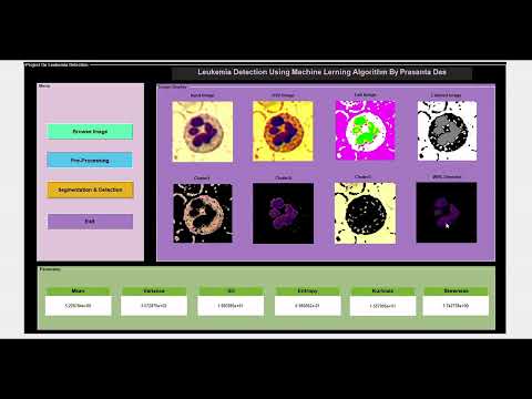 Automated Cancer (Leukemia) Detection Using Machine Learning