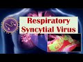 Respiratory syncytial virus rsv  what is it  what conditions does it cause ex croup