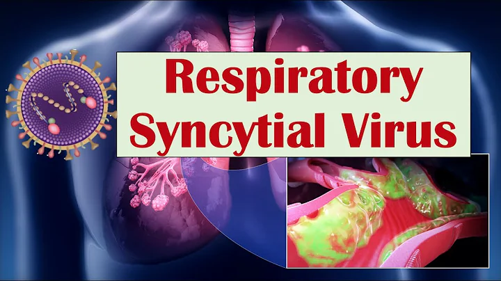 Respiratoriska syncytialvirus (RSV): Vad är det och vilka tillstånd orsakar det (exempelvis krupp)