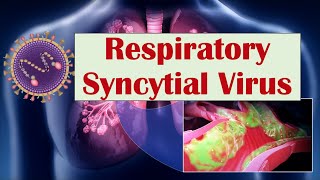 Respiratory Syncytial Virus Rsv What Is It What Conditions Does It Cause Ex Croup