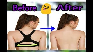 How to remove anything from a photo screenshot 5