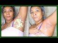 EFFECTIVELY GET RID OF DARK UNDERARMS | NOTICEABLE RESULT INSTANTLY!  |Khichi Beauty